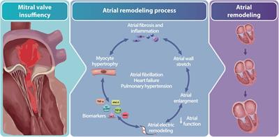 The role and implications of left atrial fibrosis in surgical mitral valve repair as assessed by CMR: the ALIVE study design and rationale